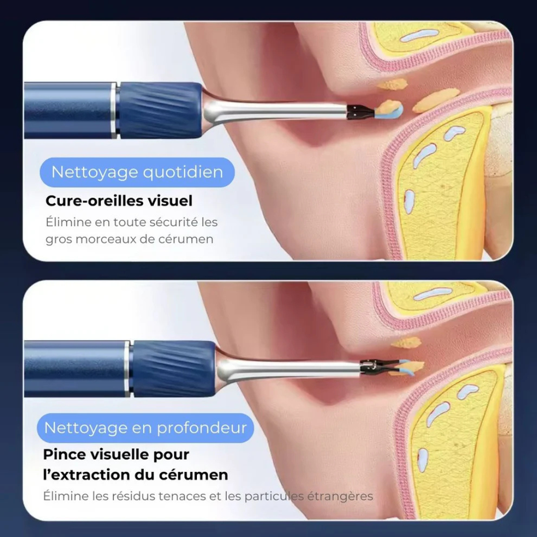 Nettoyeur d’Oreilles Sans Fil Intelligent avec Caméra 4K (Android / iOS)